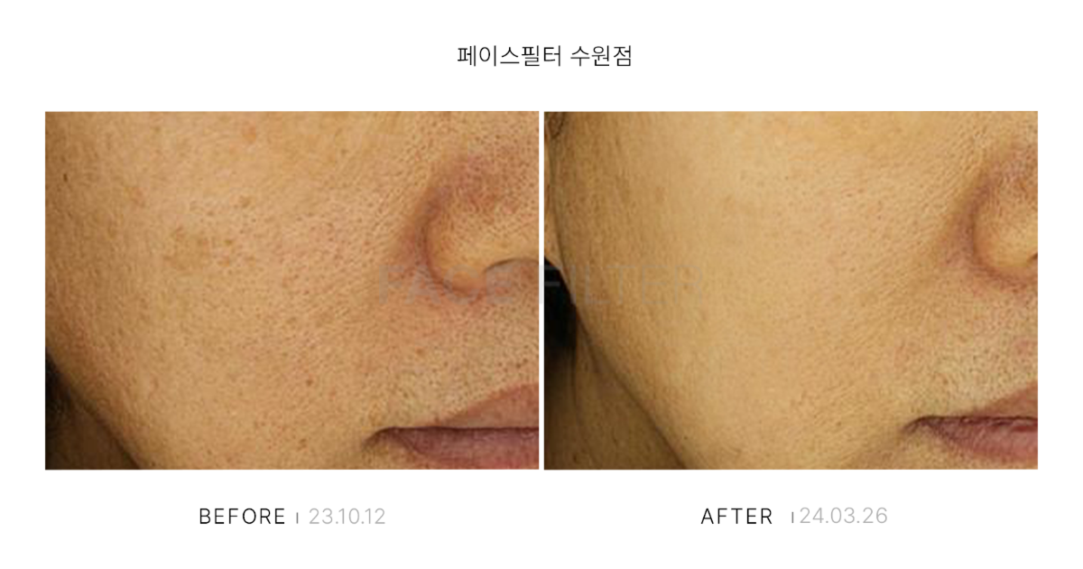 [레이저::레블라이트]