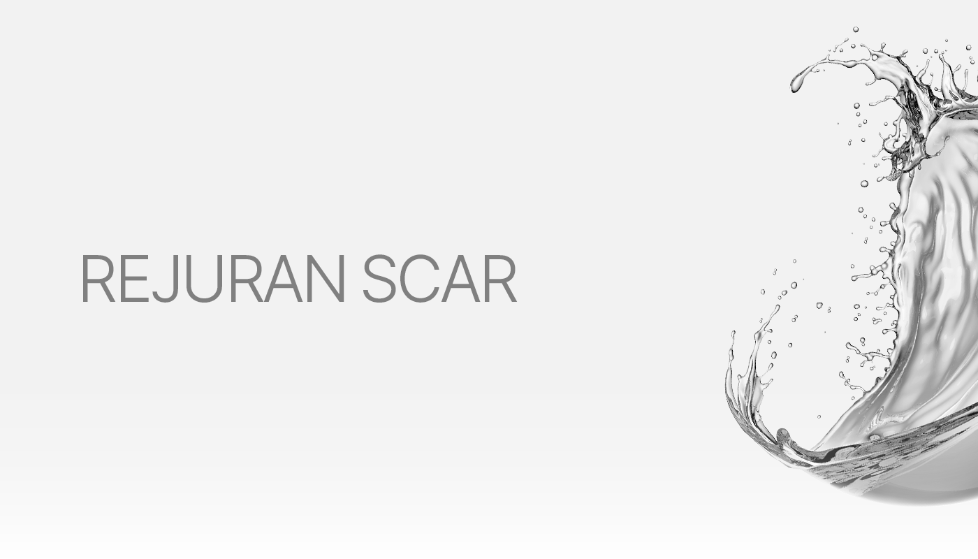 丽珠兰(Rejuran) S痘坑针